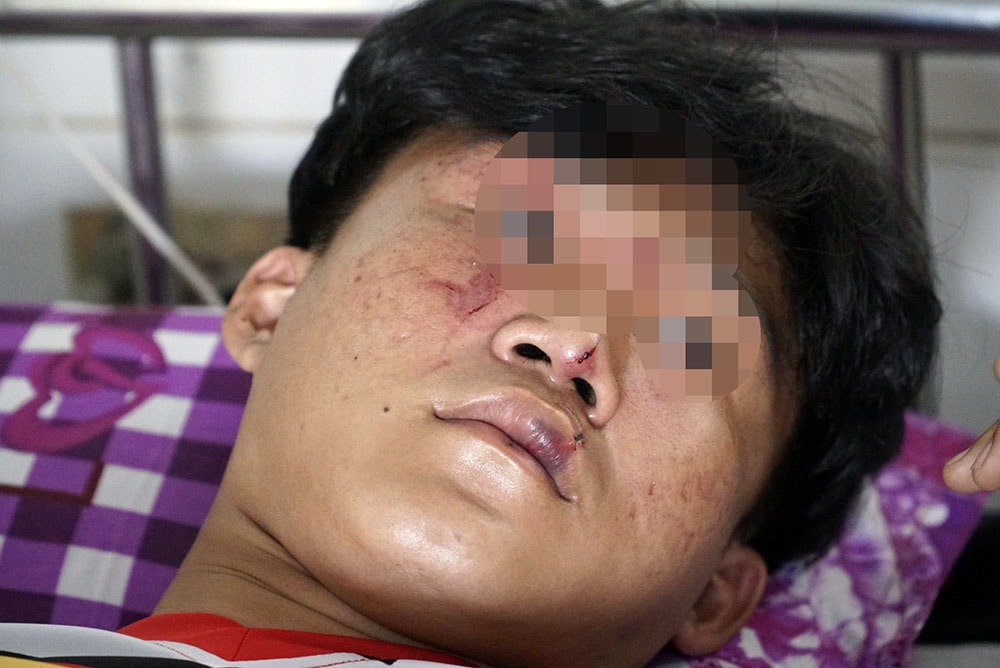 Ba học sinh ở Đồng Tháp bị nhóm người lạ vào tận trường lôi ra ngoài đánh dã man - 2